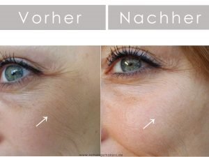 Tierversuchsfreie Gesichtspflege von Beyer & Söhne, die es tatsächlich schafft die Haut enorm zu verbessern! Falten werden reduziert dank Squalan & Hautgel+